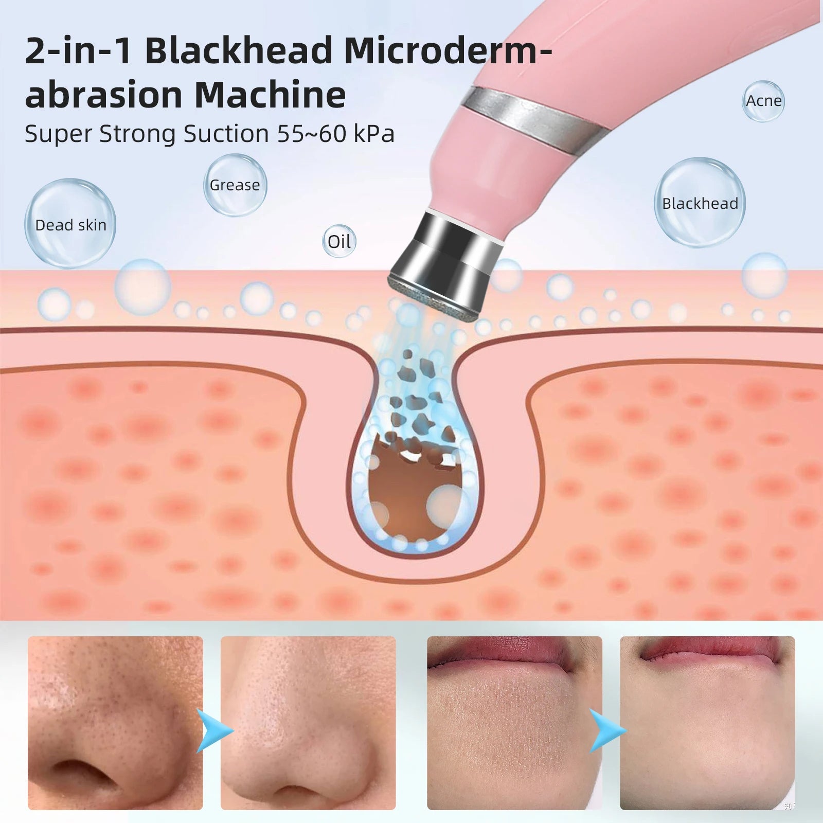 LumiGlow™ Microdermabrasion Device - Primesen